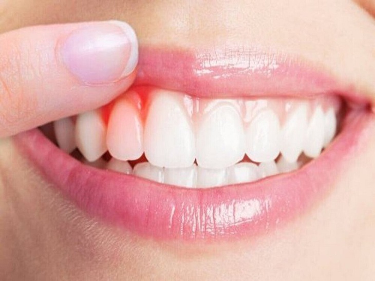 7 dấu hiệu cơ thể bạn cần được cung cấp thêm vitamin C - Ảnh 2.