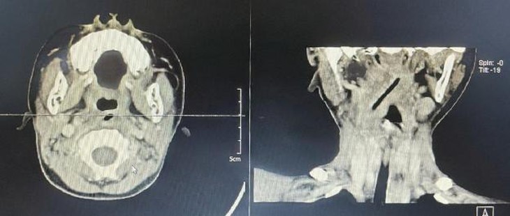 photo-1663686151437