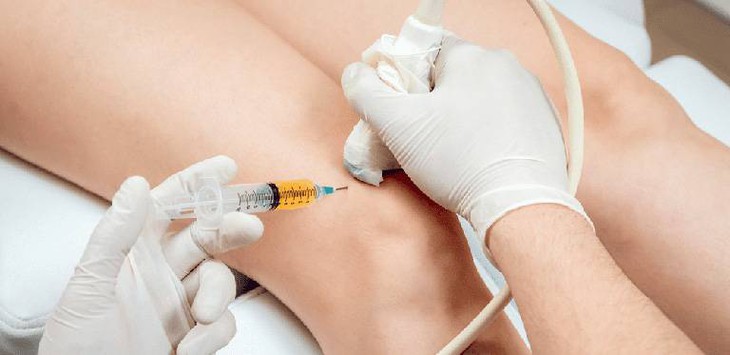 Những hiểm họa sau tiêm thuốc kháng viêm giảm đau nội khớp thiếu an toàn - Ảnh 1. Những hiểm họa sau tiêm thuốc kháng viêm giảm đau nội khớp thiếu an toàn - Ảnh 1.