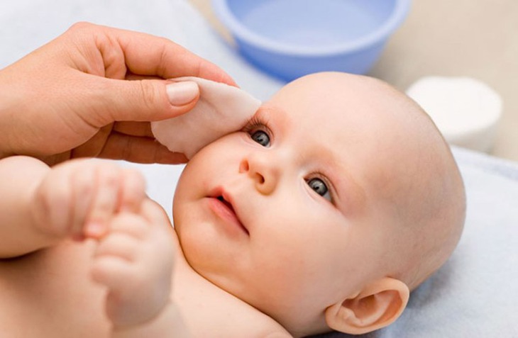 Viêm kết mạc ở trẻ em phòng và phát hiện như thế nào? - Ảnh 4.