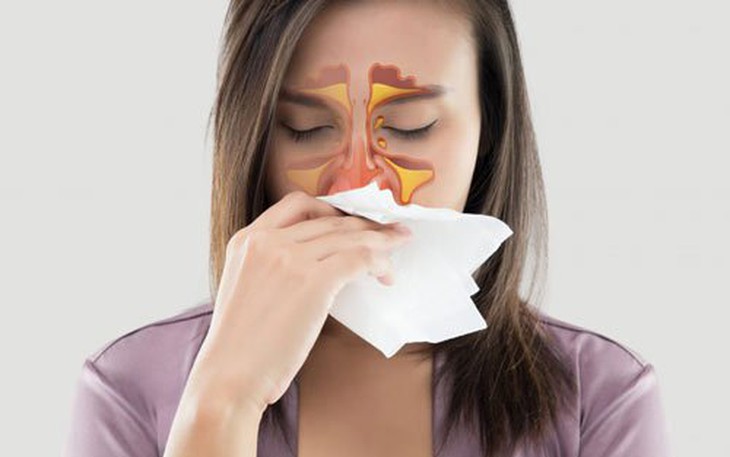3 phương huyệt chủ trị ngạt mũi, sổ mũi