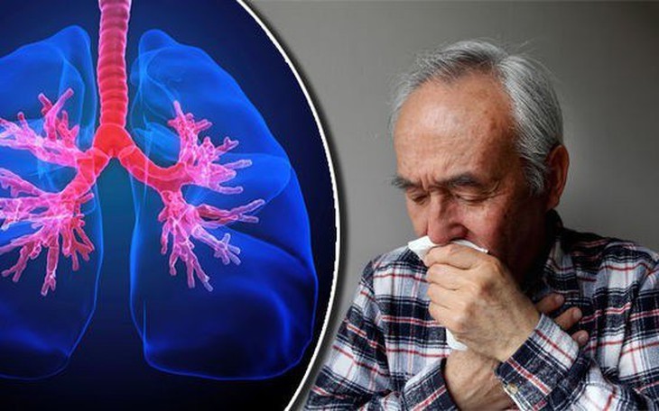 7 vị thuốc và món ăn hỗ trợ người bệnh phổi mạn tính lúc giao mùa