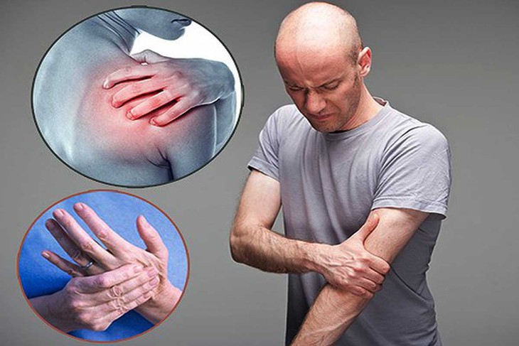 Đau vùng cổ, vai và một bên tay là biểu hiện của bệnh gì? - Ảnh 2.