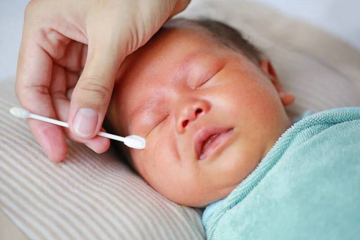 Nhận biết nguyên nhân và điều trị tắc tuyến lệ - Ảnh 3.