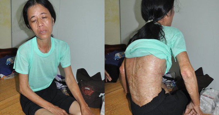 Mắc bệnh hiểm nghèo, người đàn bà đơn thân vật vã trong căn phòng nhỏ cầu cứu khẩn cấp