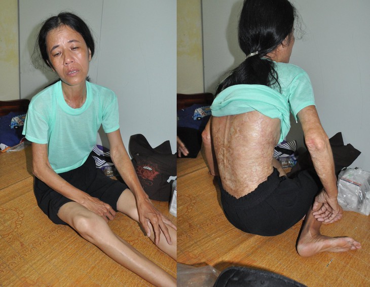 Mắc bệnh hiểm nghèo, người đàn bà đơn thân vật vã trong căn phòng nhỏ cầu cứu khẩn cấp - Ảnh 1.
