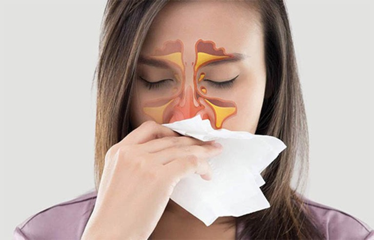 Mùa mưa bị viêm mũi, viêm xoang tái phát cần phải làm gì? - Ảnh 3. Mùa mưa bị viêm mũi, viêm xoang tái phát cần phải làm gì? - Ảnh 3.