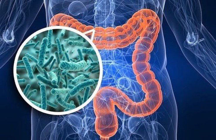 Điểm mặt 5 loại thực phẩm là “kẻ thù” của đường ruột - Ảnh 2. Điểm mặt 5 loại thực phẩm là “kẻ thù” của đường ruột - Ảnh 2.
