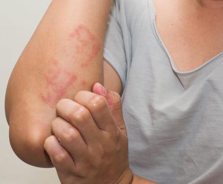 Dị ứng tinh dịch vẫn có thể sinh con - Ảnh 2.