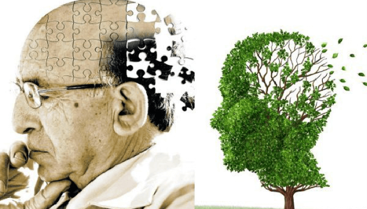 Ai là người dễ mắc bệnh sa sút trí tuệ? - Ảnh 3.