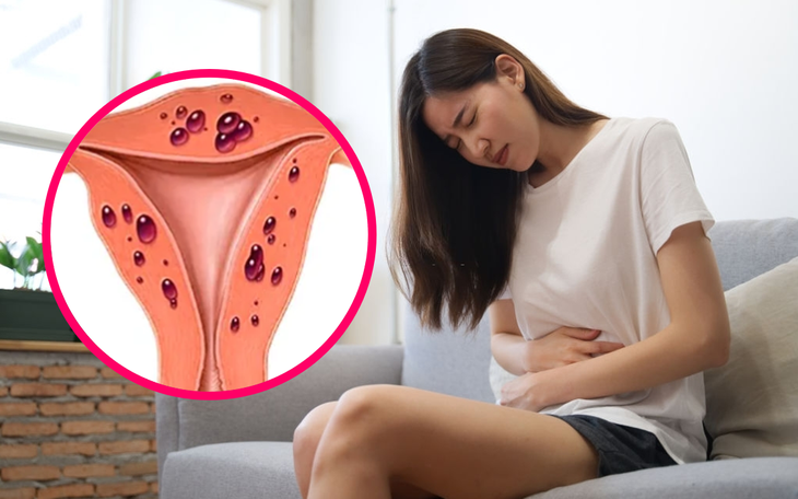 Đau vùng chậu ở phụ nữ là dấu hiệu bệnh gì?