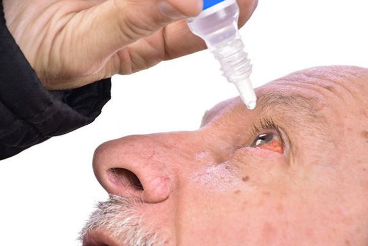 Mùa mưa bão cần chủ động phòng bệnh đau mắt đỏ - Ảnh 4.