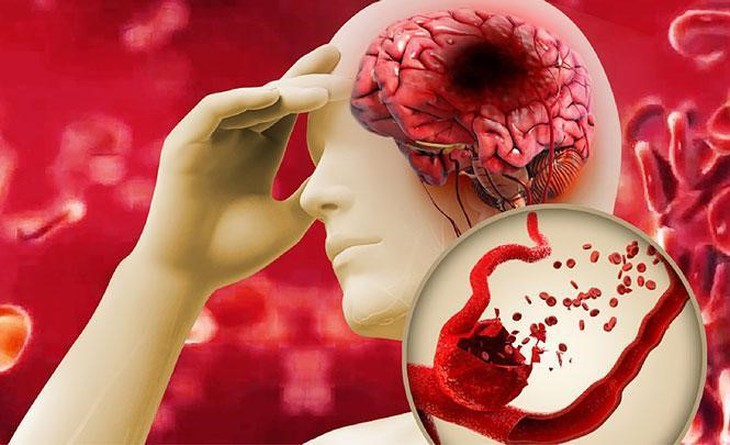 Chăm sóc sức khỏe Việt – Giúp giảm mối nguy từ mỡ máu cao - Ảnh 2. Chăm sóc sức khỏe Việt – Giúp giảm mối nguy từ mỡ máu cao - Ảnh 2.