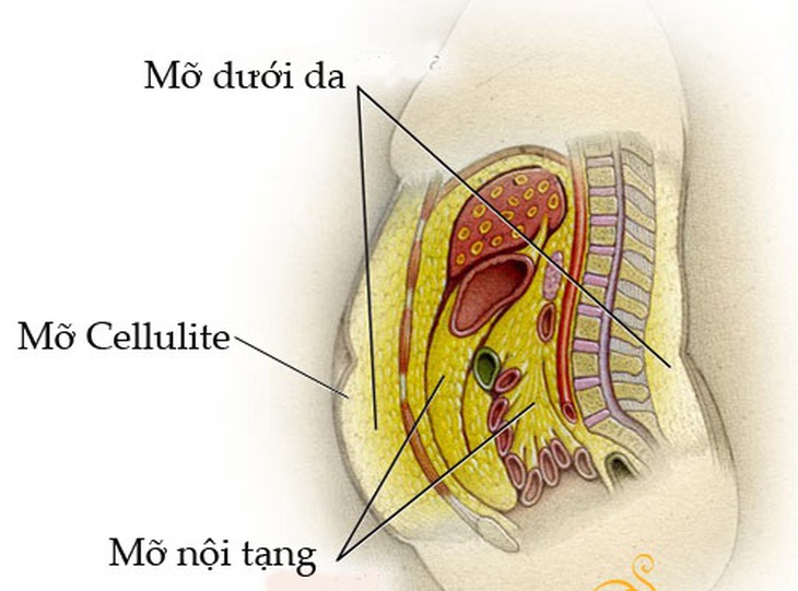 Mỡ nội tạng được dự trữ trong khoang bụng Loại mỡ này tích tụ trong các động mạch làm tăng nguy mắc các bệnh về ti, mạch, nội tiết, ung thư.