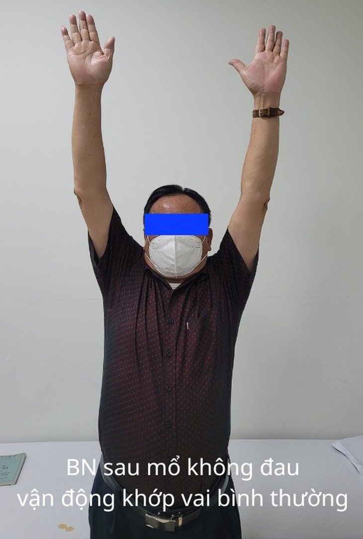 Nội soi khâu gân cơ chóp xoay khớp vai giúp người bệnh hết đau, hồi phục nhanh - Ảnh 5. Nội soi khâu gân cơ chóp xoay khớp vai giúp người bệnh hết đau, hồi phục nhanh - Ảnh 5.