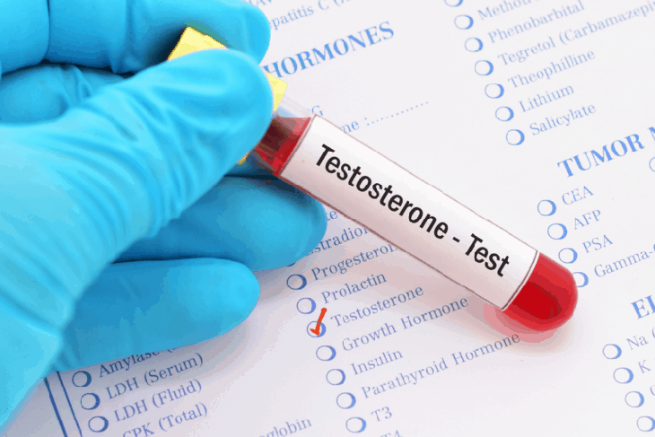 Nồng độ testosterone thấp liên quan đến tình trạng COVID-19 nghiêm trọng ở nam giới - Ảnh 2. Nồng độ testosterone thấp liên quan đến tình trạng COVID-19 nghiêm trọng ở nam giới - Ảnh 2.