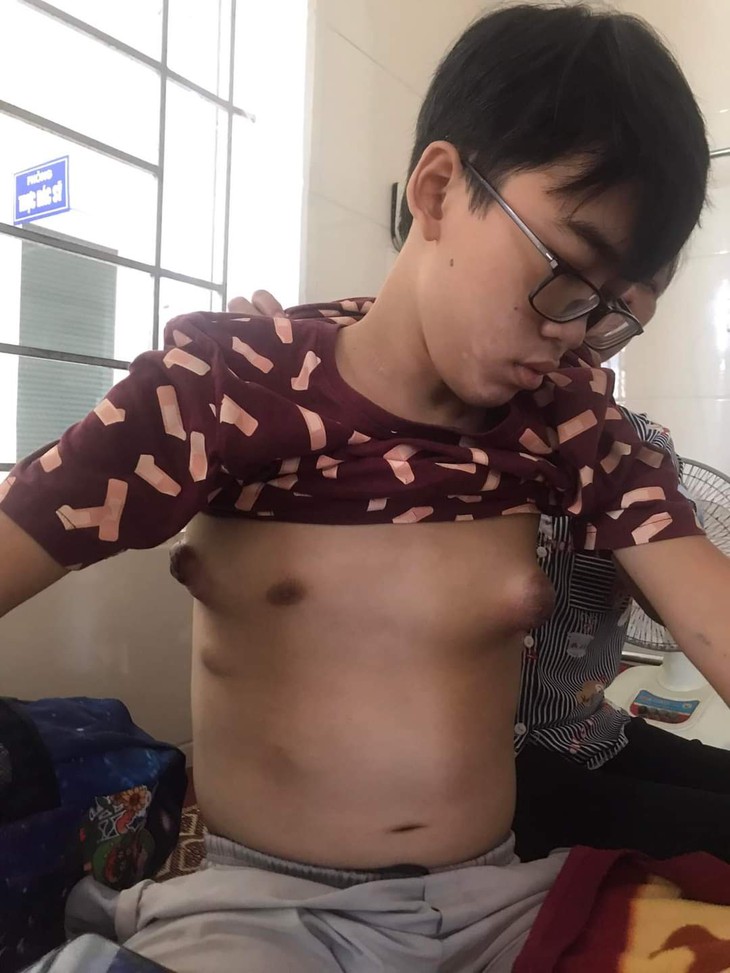 Người mẹ nghèo bất lực nhìn con trai lớp 12 đối mặt với cái chết cận kề - Ảnh 1.