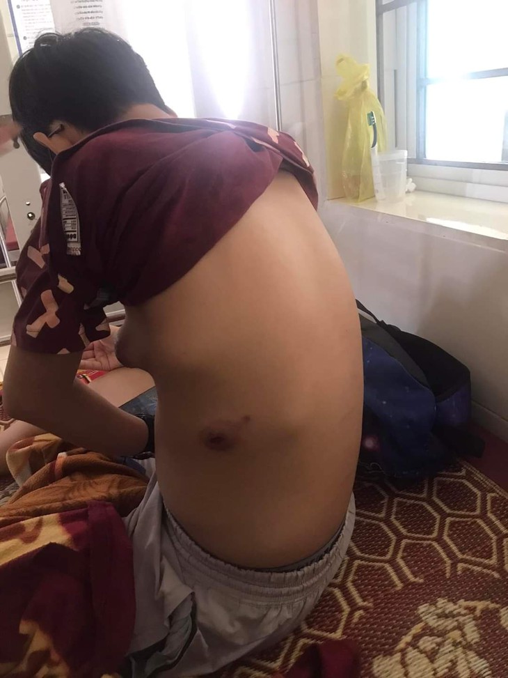 Người mẹ nghèo bất lực nhìn con trai lớp 12 đối mặt với cái chết cận kề - Ảnh 2.