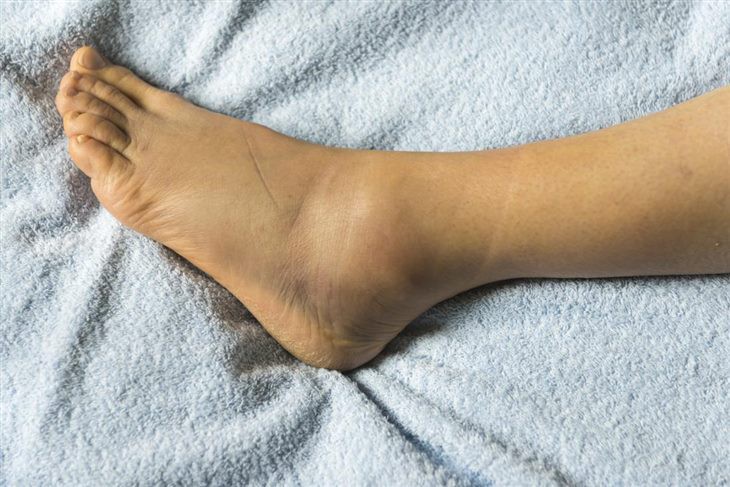 6 bệnh lý có thể khiến bạn tăng cân khó kiểm soát - Ảnh 2.