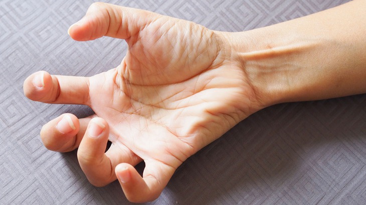 Chế độ ăn kết hợp với thuốc giúp giảm co giật ở bệnh nhân động kinh - Ảnh 1.