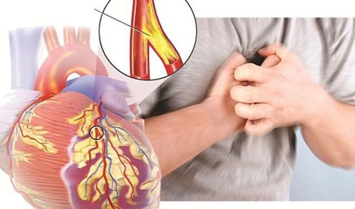 Chuyên gia mách cách ăn thịt bò cho người bị máu nhiễm mỡ - Ảnh 4.