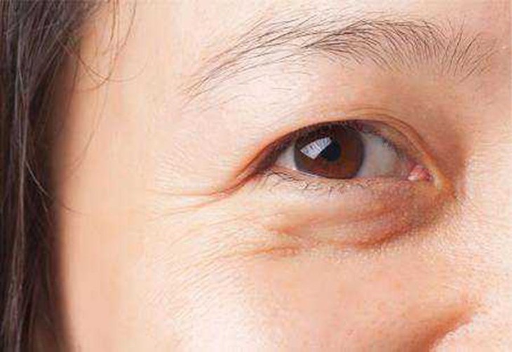 Những sai lầm khi dùng kem dưỡng da vùng mắt - Ảnh 1.
