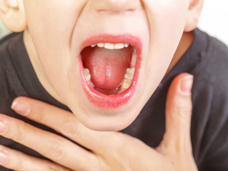 Nhiễm liên cầu khuẩn nhóm A gây ra bệnh gì? - Ảnh 4. Nhiễm liên cầu khuẩn nhóm A gây ra bệnh gì? - Ảnh 4.