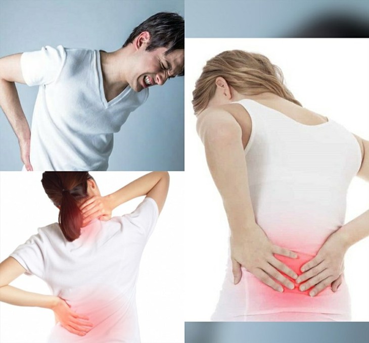 Đau lưng khi nào nên khám? - Ảnh 1.