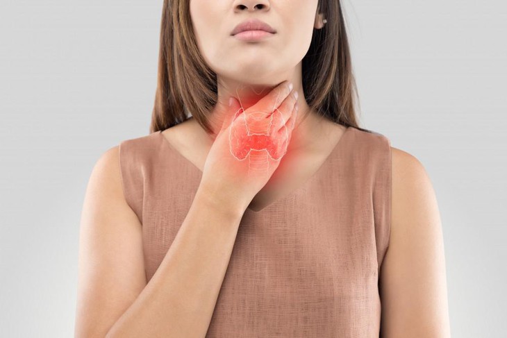 Ung thư tuyến giáp: Triệu chứng, chẩn đoán và cách điều trị - Ảnh 1.