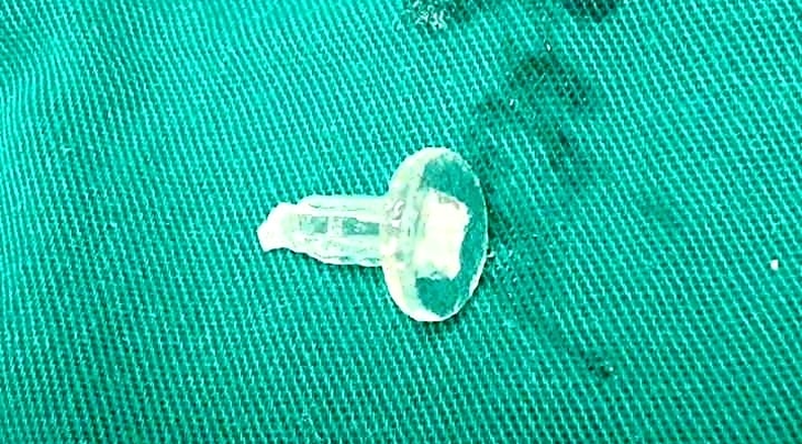 Bé trai 11 tuổi suýt chết vì thói quen ngậm bút bi - Ảnh 1. Bé trai 11 tuổi suýt chết vì thói quen ngậm bút bi - Ảnh 1.
