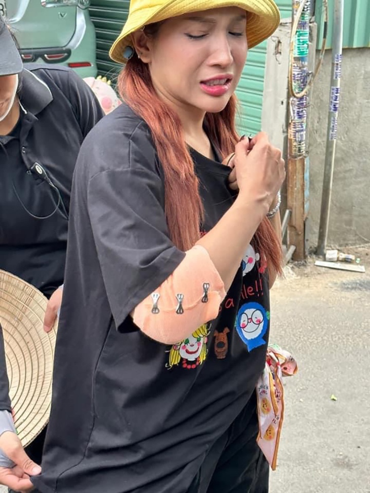 Diễn viên Khả Như gặp chấn thương khi quay gameshow - Ảnh 1.