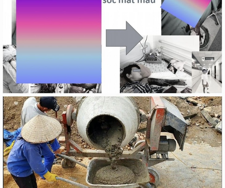 Cứu sống bé trai bị dập nát tay vì kẹt vào máy trộn bê tông - Ảnh 1. Cứu sống bé trai bị dập nát tay vì kẹt vào máy trộn bê tông - Ảnh 1.