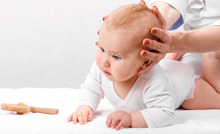 Vẹo cổ ở trẻ cần phát hiện sớm - Ảnh 3.