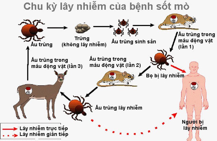 Sốt hơn 1 tuần, nam bệnh nhân 65 tuổi nhập viện phát hiện bị sốt mò - Ảnh 3.