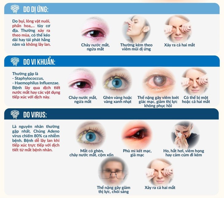 Đối phó với tình trạng đáng báo động của bệnh đau mắt đỏ - Ảnh 2. Đối phó với tình trạng đáng báo động của bệnh đau mắt đỏ - Ảnh 2.