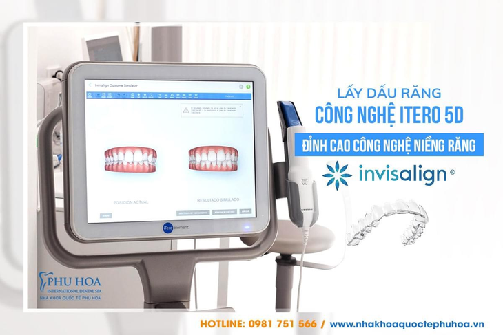 Hàm răng đẹp chưa bao giờ xa vời với cơ sở Nha khoa uy tín - Ảnh 3.