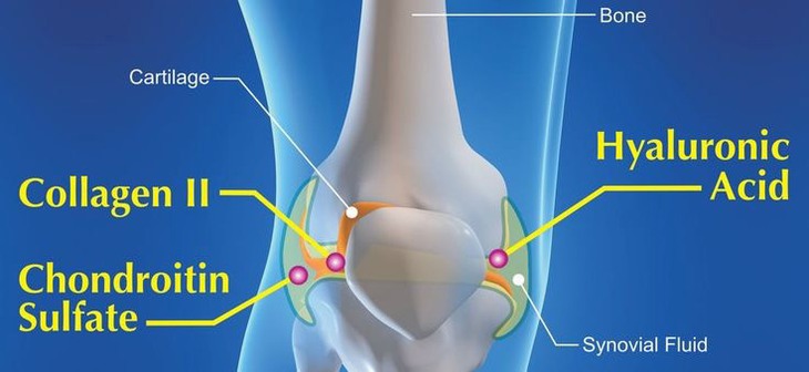 Mối liên quan giữa Axit Hyaluronic với bệnh thoái hoá khớp - Ảnh 1.