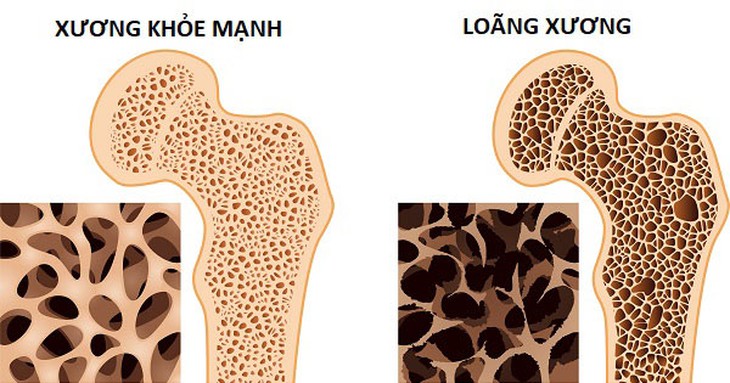 8 loại thực phẩm giàu canxi giúp xương chắc khỏe - Ảnh 2. 8 loại thực phẩm giàu canxi giúp xương chắc khỏe - Ảnh 2.
