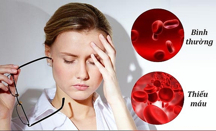 8 loại thực phẩm giúp tăng huyết sắc tố, tốt cho người thiếu máu - Ảnh 2. 8 loại thực phẩm giúp tăng huyết sắc tố, tốt cho người thiếu máu - Ảnh 2.