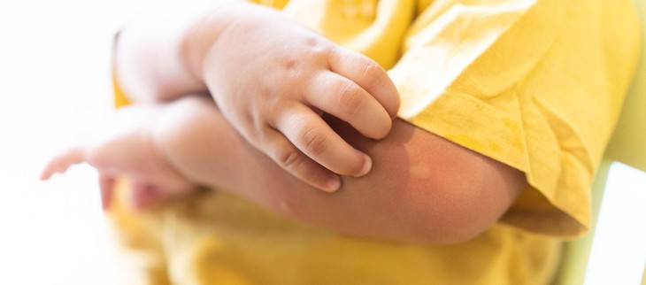 Cảnh giác khi sốt xuất huyết tăng mạnh, phân biệt sốt xuất huyết và sốt thông thường - Ảnh 1.