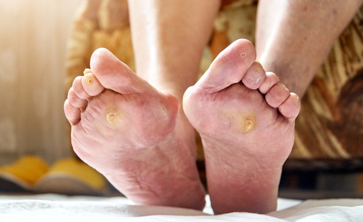 7 mẹo chăm sóc da người bệnh đái tháo đường cần biết - Ảnh 1.