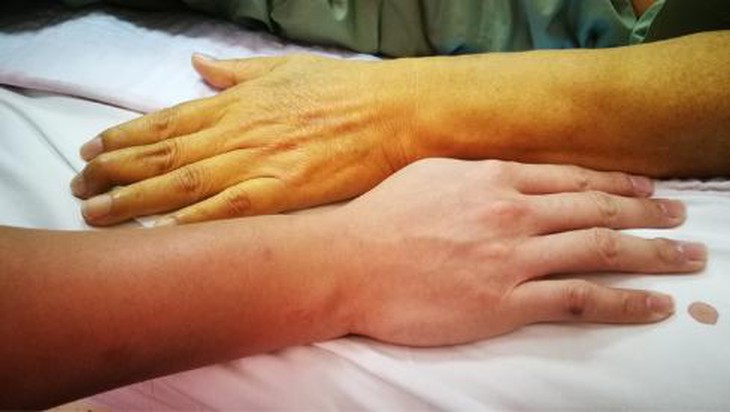photo-1698221269911