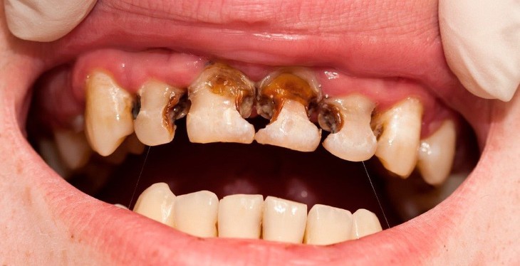 Các loại thực phẩm tốt cho răng miệng bé mà các mẹ cần lưu ý - Ảnh 1.