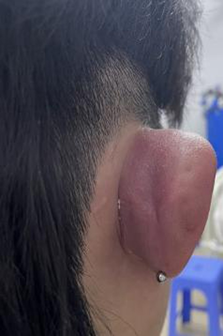 photo-1696390955191