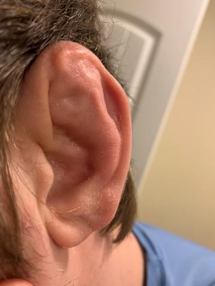 photo-1696390956248