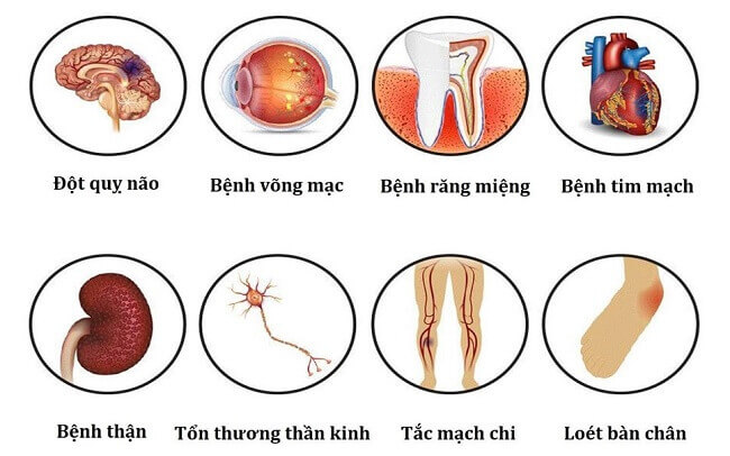 Cách hỗ trợ phòng ngừa biến chứng bệnh tiểu đường - Ảnh 1. Cách hỗ trợ phòng ngừa biến chứng bệnh tiểu đường - Ảnh 1.