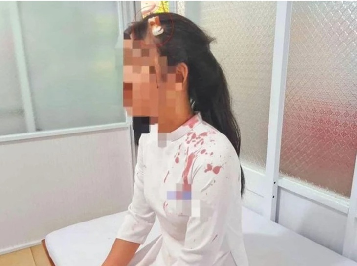 Đâu là nguyên nhân khiến bạo lực học đường không giảm? - Ảnh 1. Đâu là nguyên nhân khiến bạo lực học đường không giảm? - Ảnh 1.
