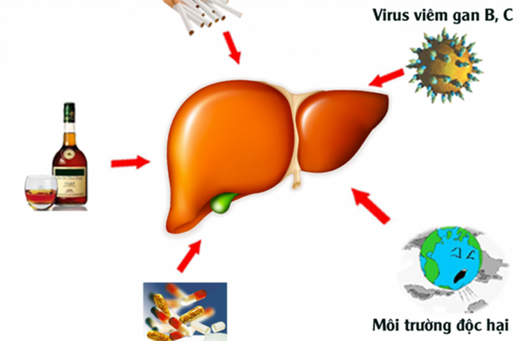 Mắc ung thư gan do “lơ là” điều trị viêm gan B - Ảnh 4.