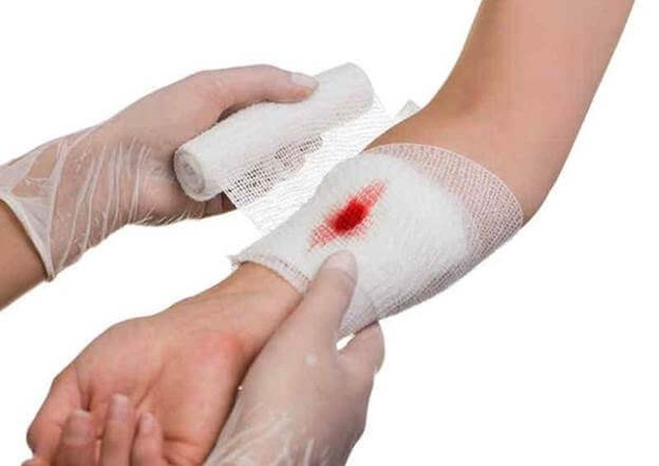 Bạn không nên chủ quan khi gặp các vết thương hở nhỏ. Bạn không nên chủ quan khi gặp các vết thương hở nhỏ.