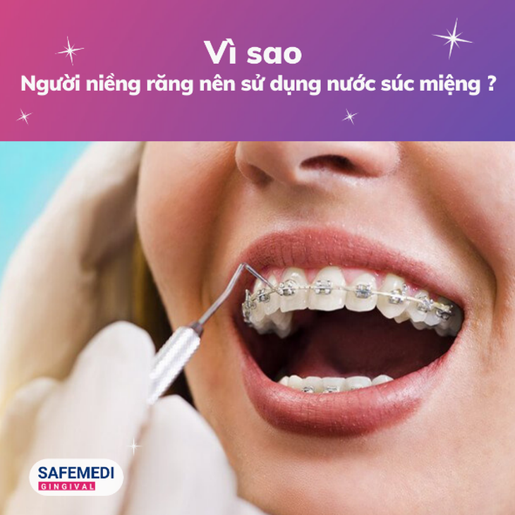 Vì sao người niềng răng nên sử dụng nước súc miệng- Ảnh 1.